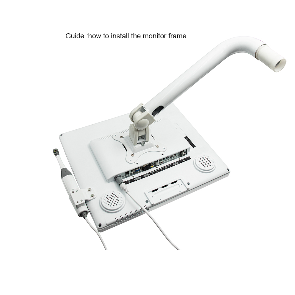 Tandheelkundige intraorale cam - Endoscope Inspection Camera recensie en prijs